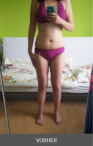 Dorothee before image